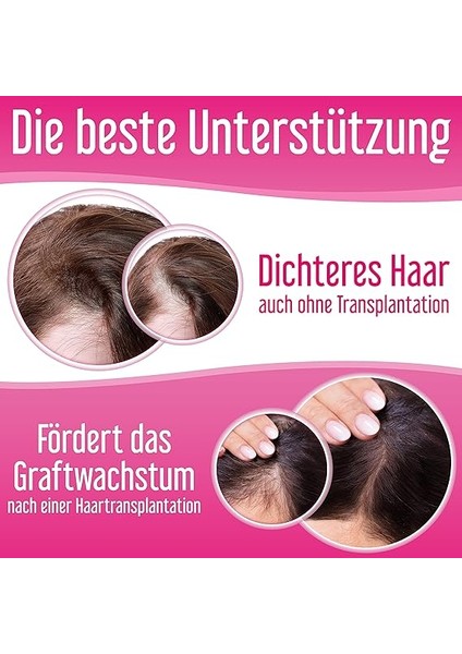 Forte Sprey%2 Procapil Kadınlar Için Saç Dökülmesine Karşı Sprey 60 ml fırsatları