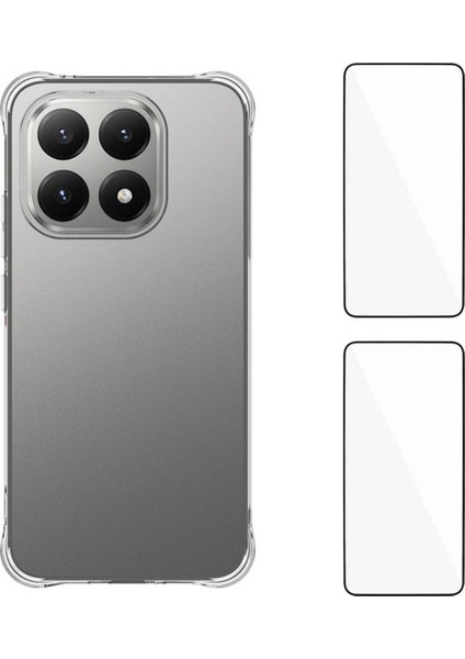 Xiaomi 15T Tpu Kılıf Telefon Kılıfı 2 Adet Temperli Cam Filmli (Yurt Dışından)