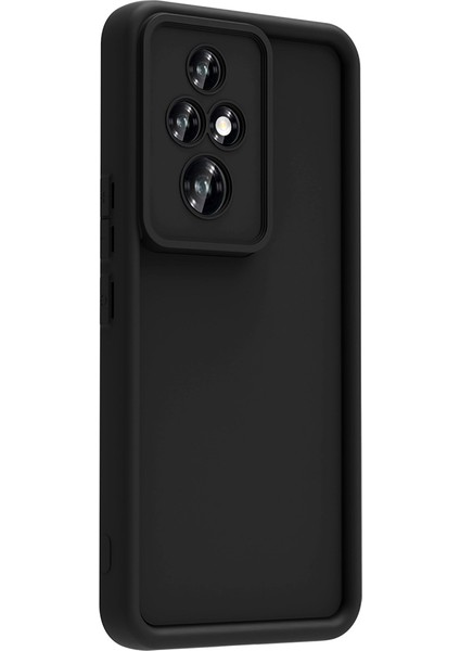 Honor 200 Pro Kılıf Kamera Korumalı Senk Ananas Kapak - Siyah modelleri