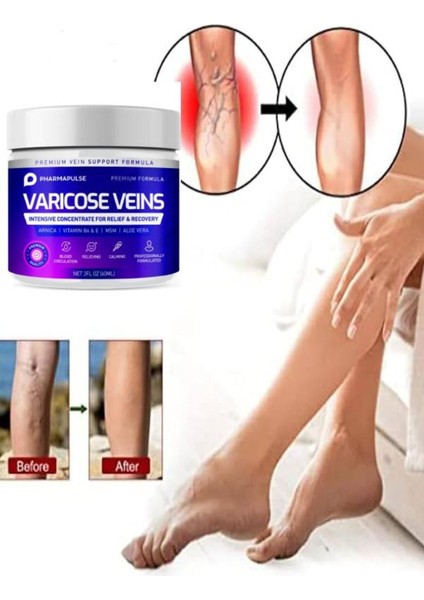 Maximum Strength Varicose Vein Var.is Bacak Bakım Masaj Kremi 100 ml 2 Adet