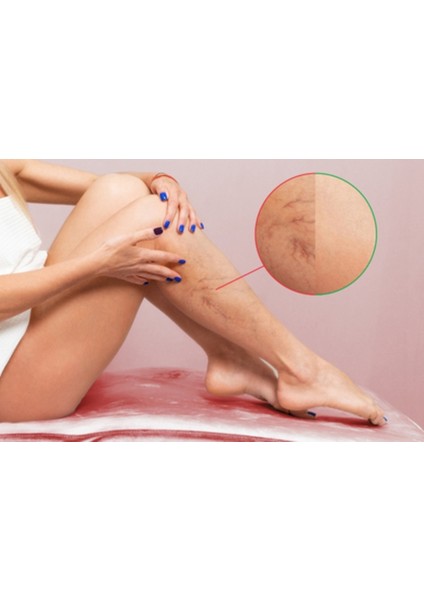 Varicose Vein Defense Cream 150 ml x 3 Bacaklar Için Bakım Kremi modelleri