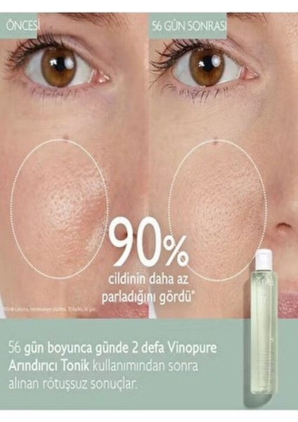 Vinopure Arındırıcı Tonik Karma Ciltler İçin Salisilik Asitli 400 ml indirimleri