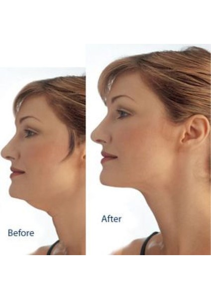 Gıdı Toparlama Boyun Gıdı Masaj Aleti fiyatları