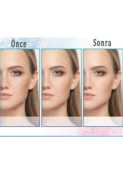 Akne, Sivilce ve Krem 30 gr & Staın Removal Cream modelleri