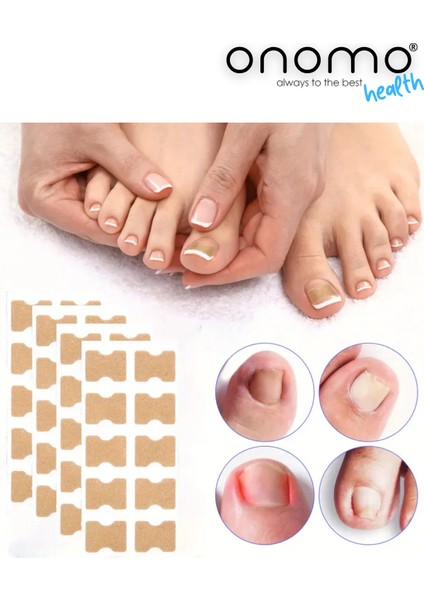 Health Ayak Batık Tırnak Düzeltme Bandı Pratik Uygulama 50 Adet Ekonomik Çözüm