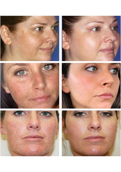 Beyazlatıcı Krem fiyatları