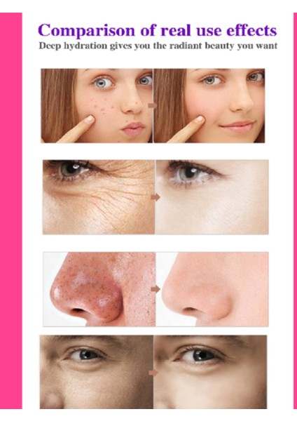 Snail White Cream Leke,,akne, Güneş Yanıkları, Doğum Izleri, Kırışıklık,yaşlanma Karşıtı Krem indirimleri