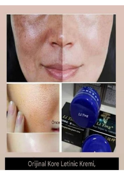 Gece Kremi + Gündüz Kremi Leke Akne Yüz Kusurları Gderici Yüz Bakım Kremi (2X20ML) fiyatları