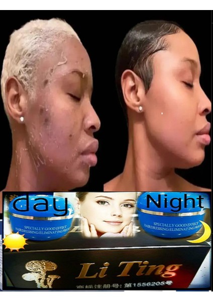 Arap Makyajı Orjinal Çin Kremi Kore Kozmetik Gece ve Gündüz Kremi Cilt Yüz Leke Akne Kremi