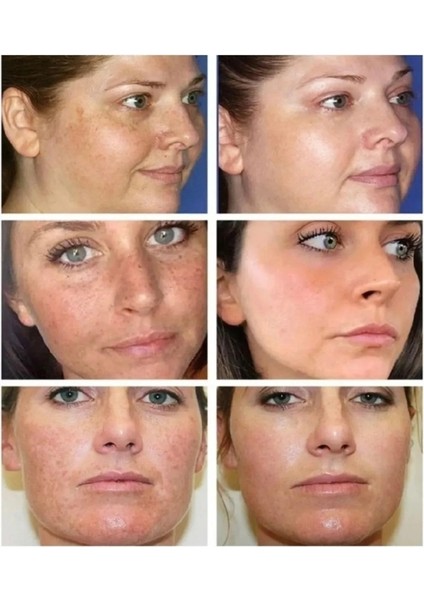 Kanza Cilt Beyazlatıcı Krem 3lu Set fırsatları