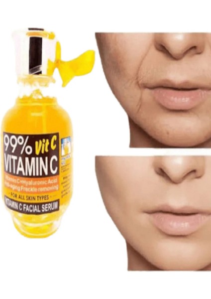 C Vitamini Leke Karşıtı Yüz Dolgunlaştıcı Yüz Gerginliği Giderici Kırışıklık Karşıtı Serum
