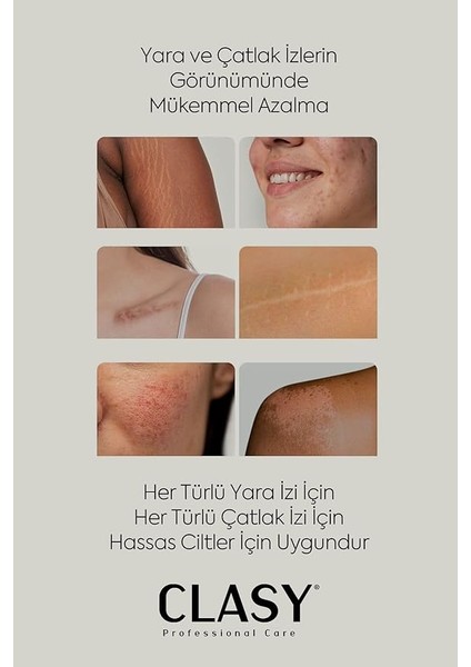 Care Yara ve Çatlak Izleri Görünümünü Azaltıcı ve Mükemmel Önleyici Krem (Scars & Stretch Marks Cream) fırsatları