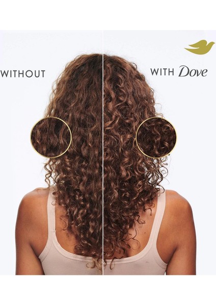 Damage Kuruluk Karşıtı Kepek Şampuanı 355ML fırsatları