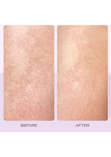 Soft + Smooth Starter Kit - Yumuşaklık + Pürüzsüzlük Verici Başlangıç Seti 113 G + 28,3 G + 28 Disk