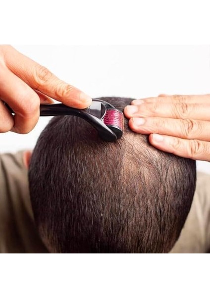 Dermoroller 540 Mikro Iğneli 0.5mm - Cilt ve Saç Bakımı Için Dermaroller - Yüz, Saç Derisi, Cilt Yenileme ve Gözenek Sıkılaştırma - Mikro Iğne Terapisi - Kolay Kullanım ve Etkili Sonuçlar indirimleri