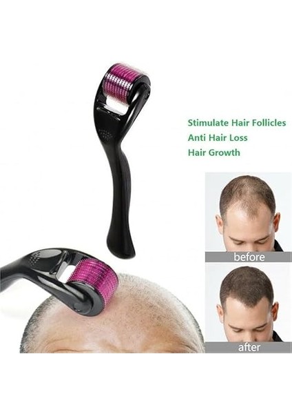 Dermaroller 0,5 mm 540 Titanyum Iğne Cilt Bakımı, Yüz Kırışıklıkları Için Saç Dökülmesi, Sakal Büyümesi, Saç Büyümesi, Mikro Iğneler, Profesyonel Mikro Iğneler (0,5mm) modelleri