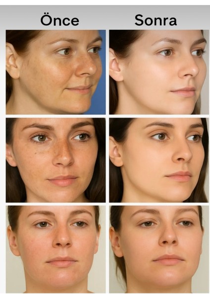 Beauty Cream(5in1)Set modelleri