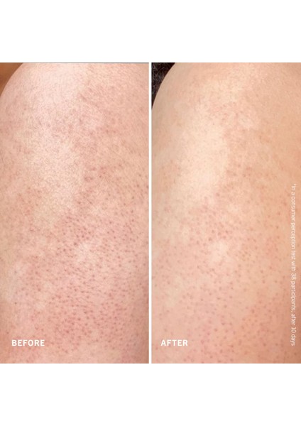 Smooth + Juicy Scrub Kit - Keratosis Pilaris Için Vücut Peeling Kiti 56,7 G + 56,7 G + 56,7 G indirimleri