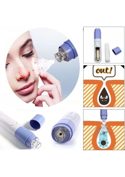 Siyah Nokta Temizleme - Yüz Temizleme Cihazı Vakumlu Siyah Nokta Temizleme Cihazı modelleri