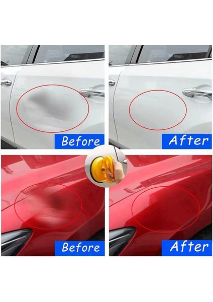 Dent Çekme Araba Dent Çekme 3 Paket Diş Çıkarma Kiti Sap Kaldırıcı Güçlü Araba Diş Çıktırıcı Emme Kupası Diş Çekme (Yurt Dışından) fırsatları