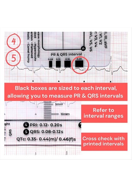 2pcs Ekg 7 Adım Cetvel Ekg 7 Ekg/ekg Yorumlama Ekg Cetvel Taşınabilir Ekg Değerlendirme Aracı Ekg Kartı (Yurt Dışından) indirimleri