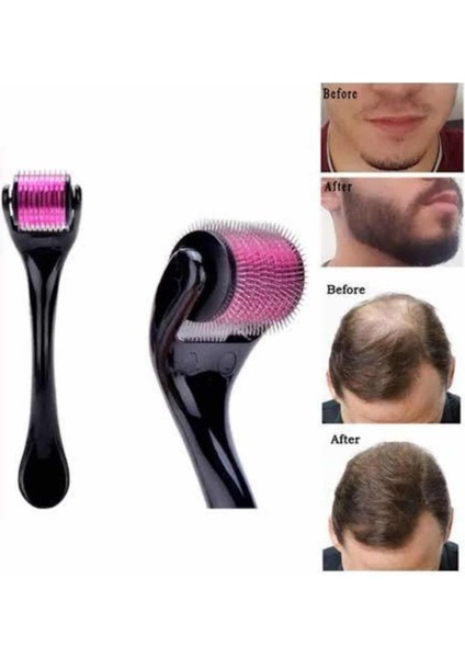 Techmrt Saç Çıkarma Tarağı Dermaroller 540 Iğneli Roller 1 mm Iğne Cilt Yüz Yenileme Bakım Seti modelleri