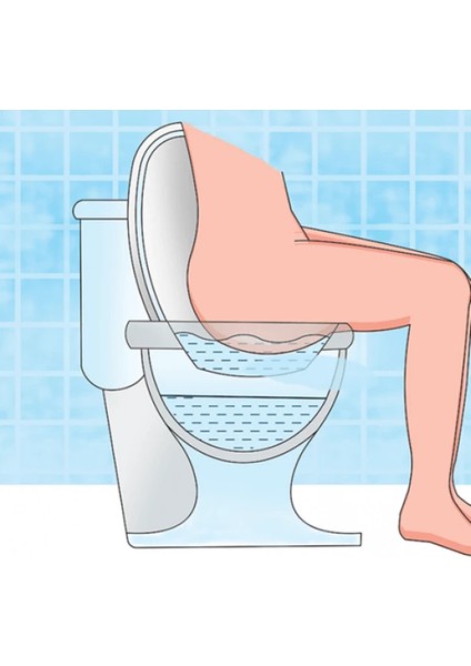 Hemoroit Küveti – Sitz Banyosu Doğum Sonrası & Bakım Küveti modelleri