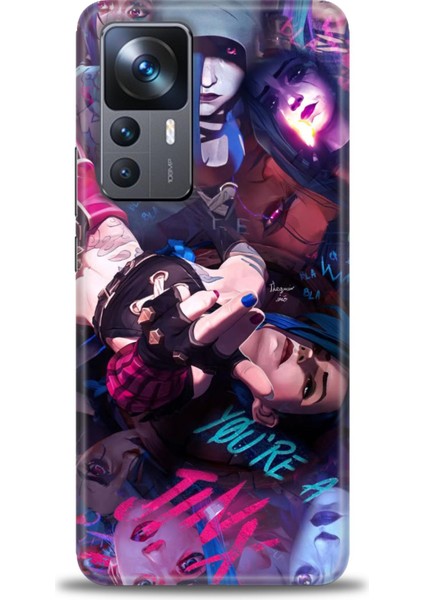 Xiaomi Mi 12T Pro Kılıf Hd Baskılı Kılıf + Seramik Tam Kaplayan Ekran Koruyucu 278