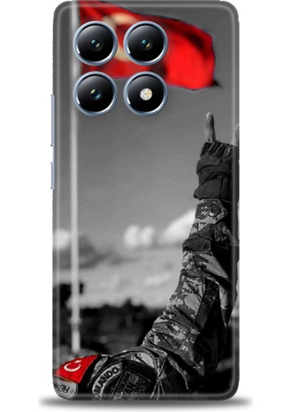 Xiaomi Mi 14T Kılıf Hd Baskılı Kılıf + Seramik Tam Kaplayan Ekran Koruyucu 35