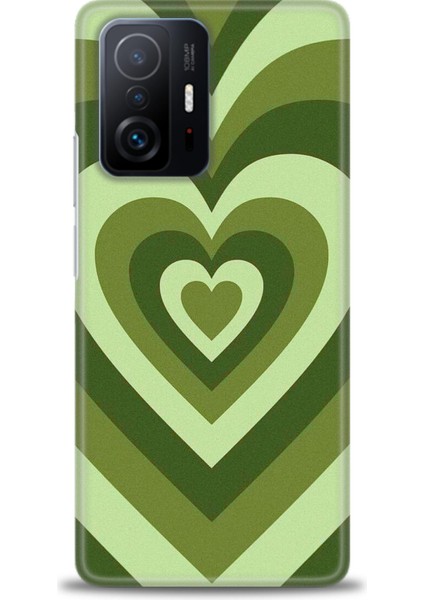 Xiaomi Mi 11T Pro Kılıf Hd Baskılı Kılıf + Seramik Tam Kaplayan Ekran Koruyucu 200