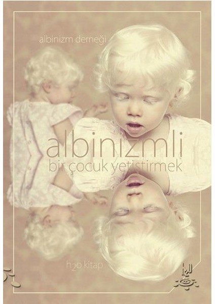 Albinizmli Bir Çocuk Yetiştirmek