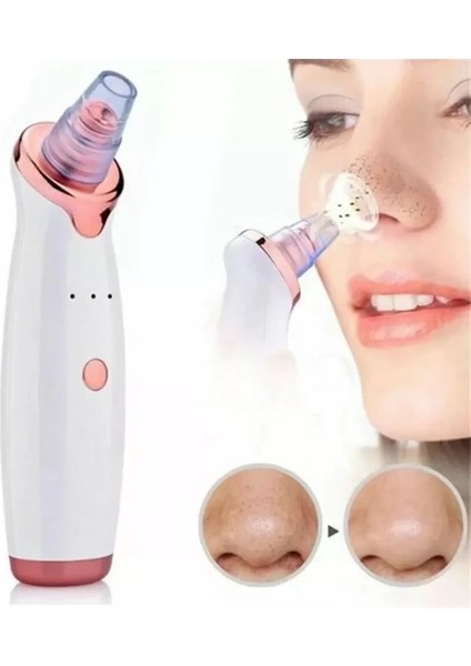 Şarjlı Siyah Nokta Temizleme Cihazı 5 Başlıklı (4915)