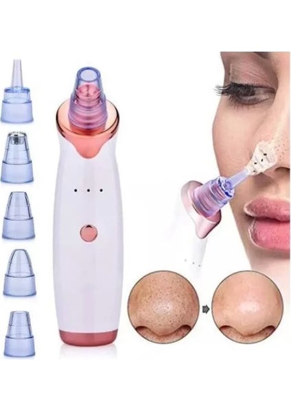 Şarjlı Siyah Nokta Temizleme Cihazı 5 Başlıklı (4915) indirimleri