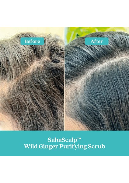 Saç Derisi Yenileme Kiti Sahascalp™ - Saç Bakım Seti 14,4 ml + 50 ml + 50 ml fırsatları