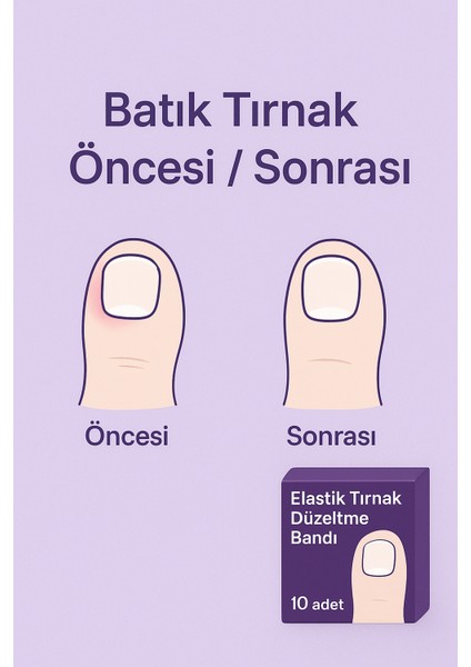 Ayak Tırnağı Düzeltme Bandı 10 Adet modelleri