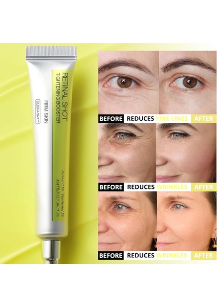 Retinal Shot Tightening Booster 15ML (Medicube Maske Hediyeli) indirimleri