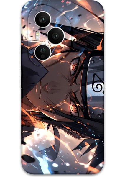 Honor 400 Pro Uyumlu Anime Desenli Telefon Kılıfı + Ekran Koruyucu - 5923