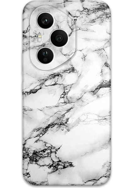Honor 400 Pro Uyumlu Mermer Desenli Telefon Kılıfı + Ekran Koruyucu - 5817