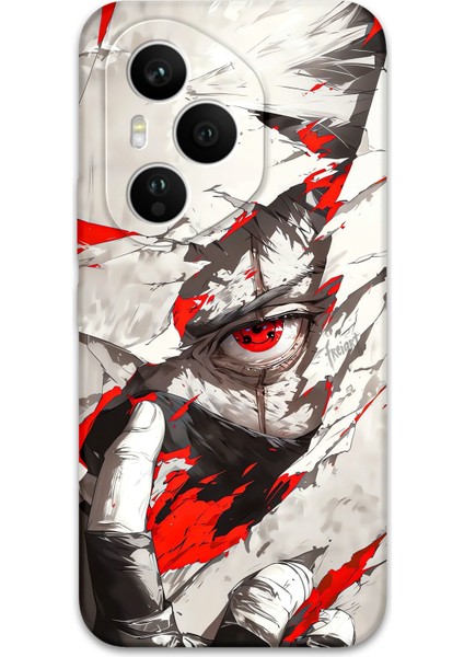 Honor 400 Pro Uyumlu Anime Desenli Telefon Kılıfı + Ekran Koruyucu - 5876