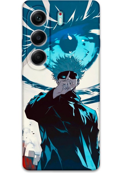 Tecno Camon 40 Pro 5g Uyumlu Anime Desenli Telefon Kılıfı + Ekran Koruyucu - 5904