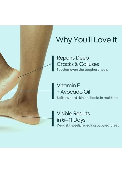 Clasycare Topuk Çatlağı Kremi – Kuru ve Çatlamış Topuklar Için – E Vitamini ve Avokado Yağlı Topuk Kremi – Nasır, Sert ve Ölü Deriler Için Nemlendirici Ayak Bakım Kremi – 100 ml fiyatları