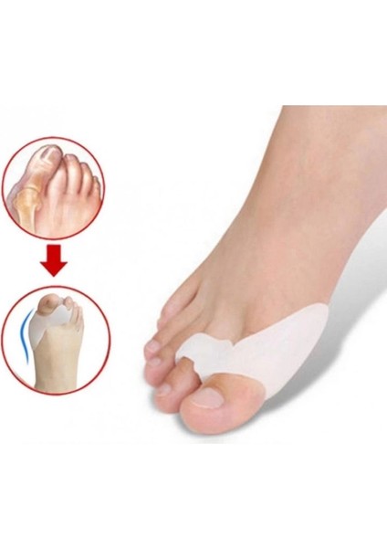 Bfs Baş Parmak Bunyon Silikonu Parmak Arası Destek Medikal Silikon Ağrı Azaltmaya Yardımcı fiyatları