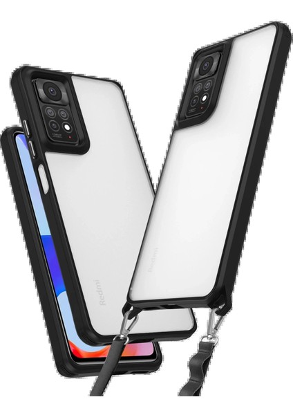 Newface Xiaomi Redmi Note 11 Pro Kılıf Penta Silikon Kılıf - Siyah