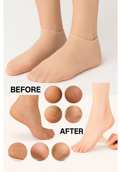 Topuk Çatlaklarına Karşı Silikon Jel Ayak Nemlendirici Maske Spa Bakım Çorabı Ayak Bakım Çorap modelleri