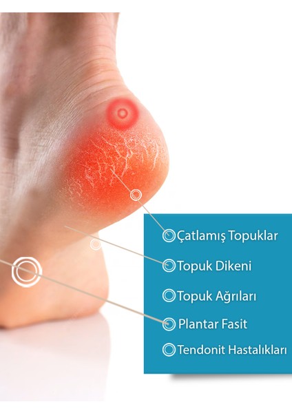 Silikon Destekli Topuk Çorabı (2 Adet - Medium)– Topuk Ağrısı, Çatlak Topuk, Ayak Tabanı Ağrısı ve Yorgunluk fiyatları
