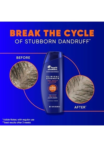 Head & Shoulders Klinik Kepek Savunması + Kuru Saç Derisi Kurtarma Şampuanı 13 Oz Ikiz Paket modelleri