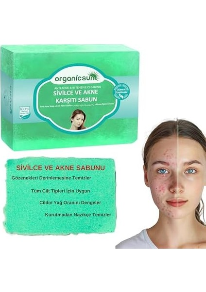 Organicsun Doğal Akne ve Sivilce Karşıtı Sabun 140 gr Tüm Cilt Tipleri Için Natural Sabun modelleri