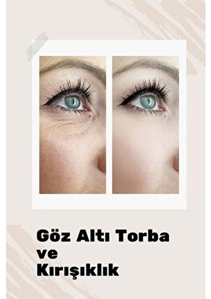 Göz Çevresi Kırışıklık Önleyici Serum Nemlendirici Etkiyle 30 ml