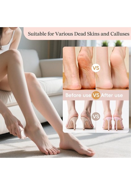 Elektrikli Ayak Nasır Giderici, 3 Ayarlanabilir Hız (Yurt Dışından) fiyatları