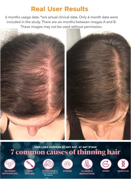 Woman - 5000 Mcg Biotin, Saw Palmetto, Keratin, Kolajen, Amino Asitler, Bitkisel Ekstreler ve Vitaminler 60 Tablet